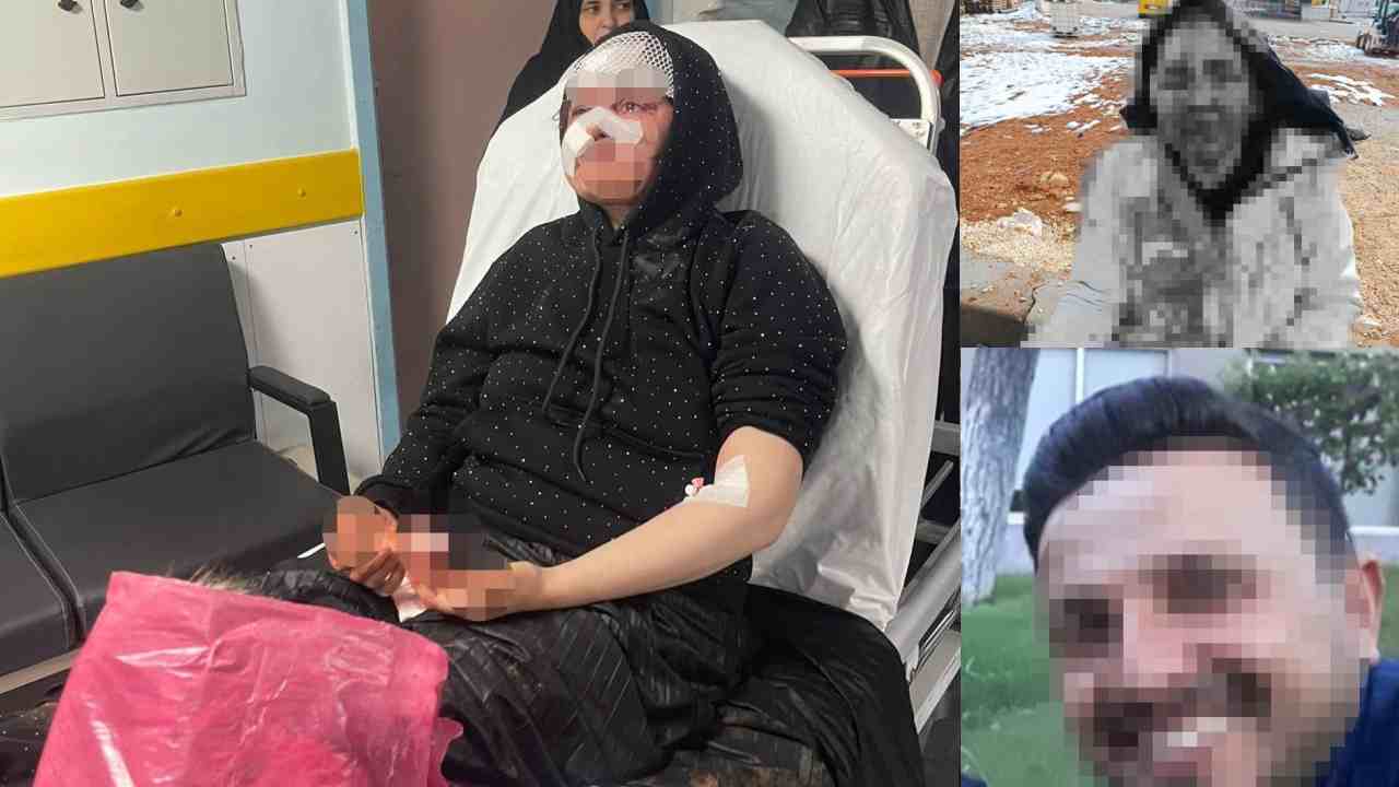 Boşanmak isteyen kadına saldıran koca tutuklandı