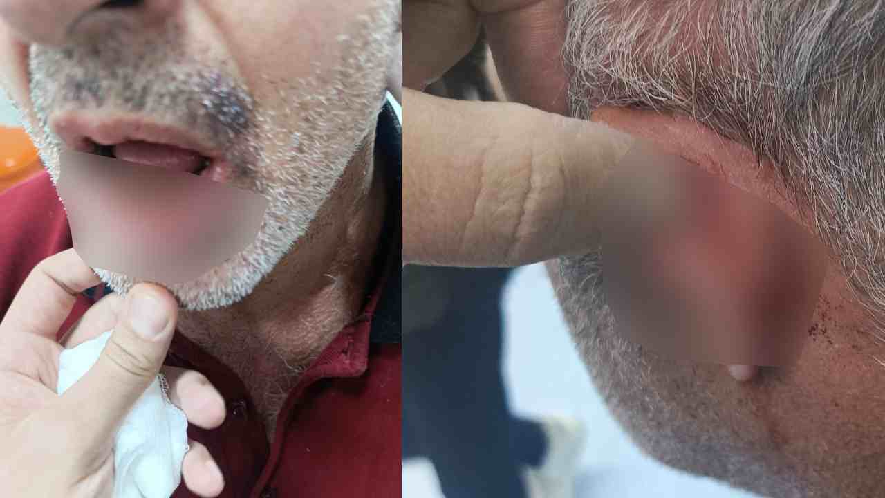 Hastanede Maaş Tartışması: Darp Skandalı Patlak Versin!