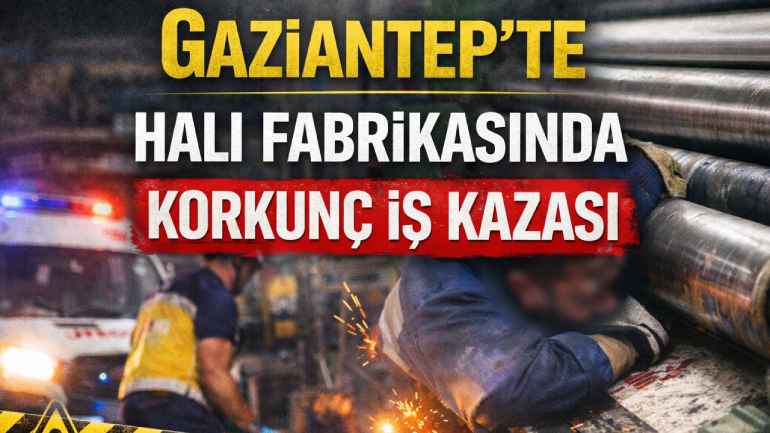 Fabrikada İş Kazası: İşçi Ağır Yaralandı Fabrikada İş Kazası: İşçi Ağır Yaralandı
