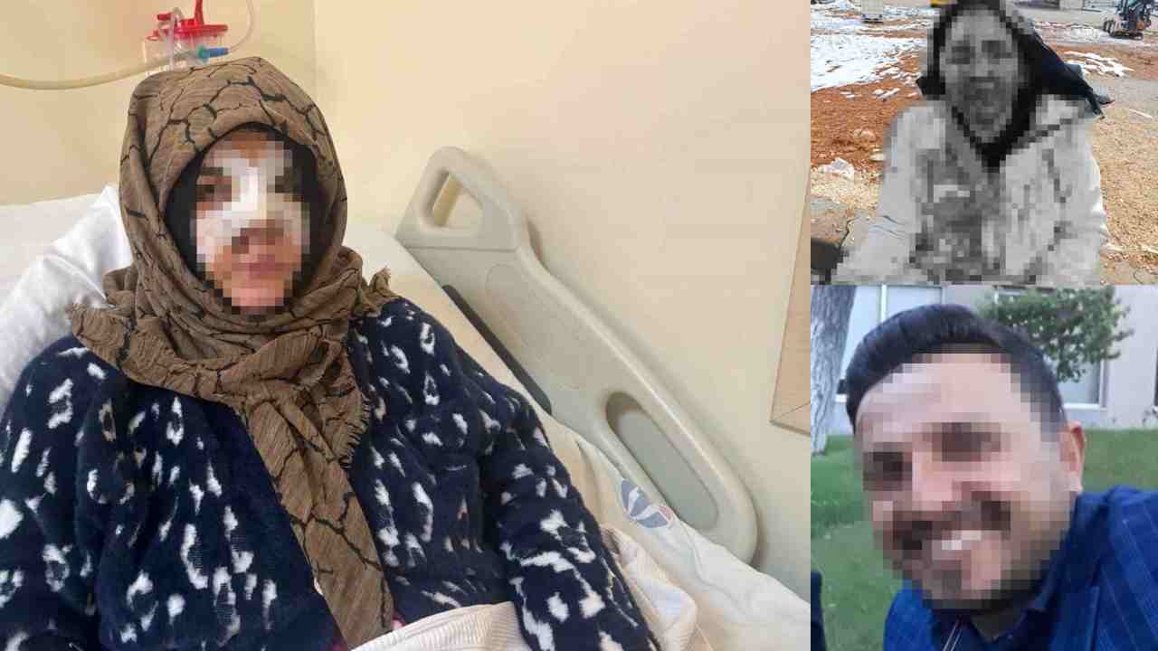Boşanma Kavgasında Taşlı Darp: Kadın Ağır Yaralandı