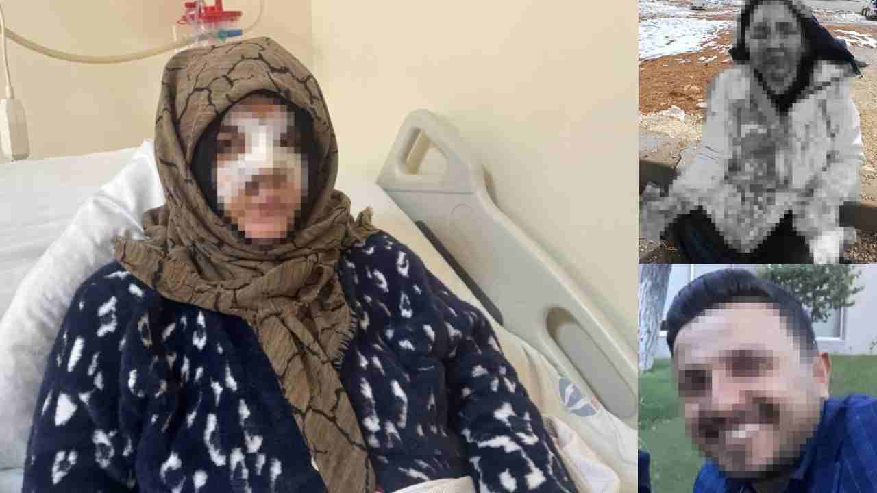 Boşanma Kavgası: Eşine Taşla Saldırdı!